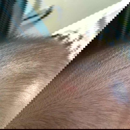 Con  đc hơn 5m r ạ
Mà nay e thấy có cục mụn vậy có sao ko ạ