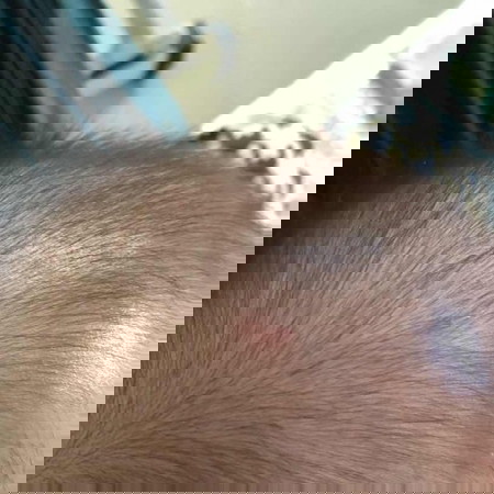 Con đc hơn 5m r ạ
Mà nay e thấy có cục mụn vậy có sao ko ạ