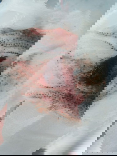 ก้อนเลือดแบบนี้คือก้อนเลือดของน้องไหมคะ