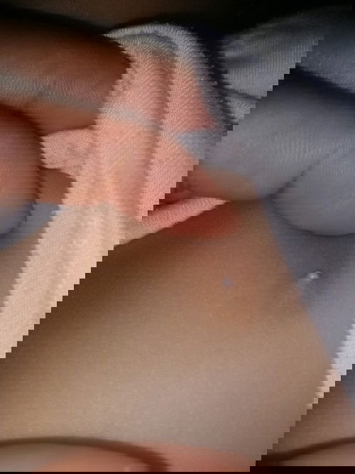 Đầu ti bé nổi hạt trắng