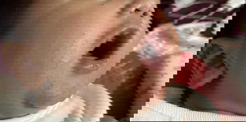 ผดผื่นเด็กอ่อน