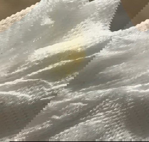 มีมูกใสไหลออกมา อีกนานไหมคะกว่าจะคลอด(ขออภัยในความไม่เหมาะสมของถาพค่ะ)