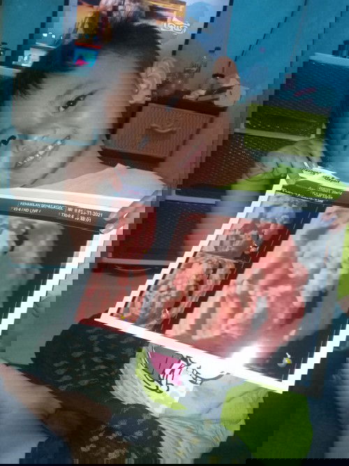 Penasaran jenis kelamin