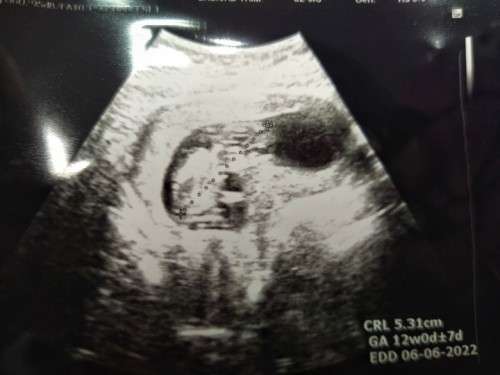 ซาวด์แล้วเจอน้องนั่ง