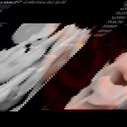 USG 4D hamil usia 4 bulan