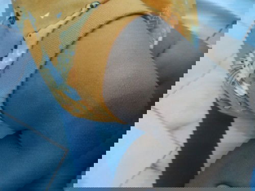 Kulit kaki dan tangan tidak merata