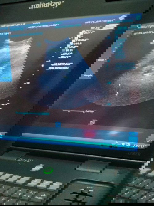 bulat kecil dan gumpalan apakah kantung dan bakal janin