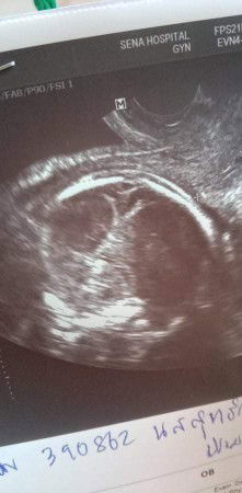 เพศน้องเพศอะไรค่ะแม่ๆ