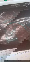 เพศน้องเพศอะไรค่ะแม่ๆ