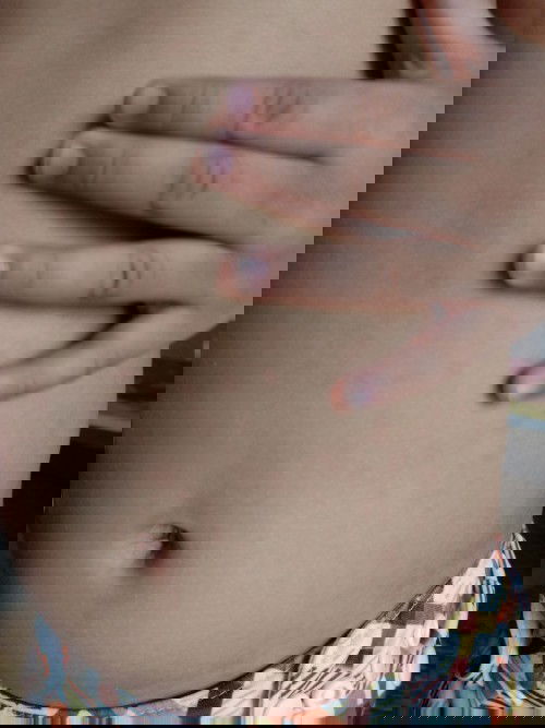 Rashes po ba ito. Or Allergy sa Milk po?