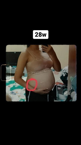 เจ็บท้องท้องแข็งบ่อย