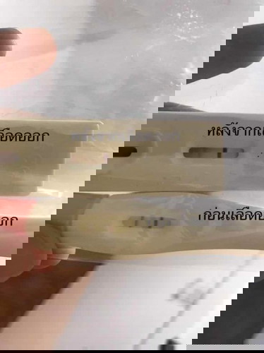 งงไปหมดแล้วค่ะคือเราเสียน้องไปแล้วตั่งแต่วันเลือดออก! ใครเคยเป็นแบบนี้บ้างคะ