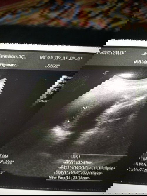 hasil pemeriksaan USG