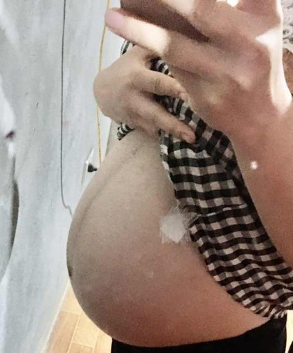 Các mom cho mk hỏi bụng như vậy là tụt chưa ạ
38 tuần rồi vẫn chưa thấy rục rịch gì