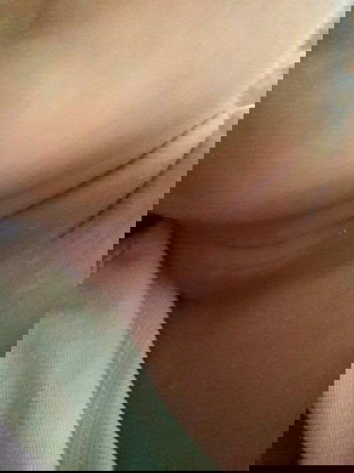 Gamot para sa puting rashes