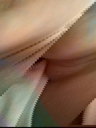 Gamot para sa puting rashes