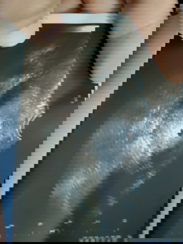 Bleeding macam darah haid hamil 5w