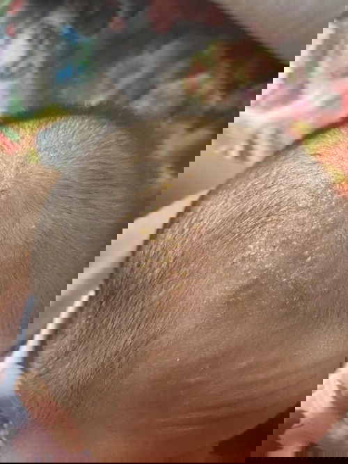 หัวน้องเป็นแบบนี้ทำยังไงให้หายคะ