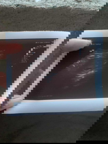 Normal Lang ba to na 7 weeks and 6 days ka ng buntis pero Hindi pa makita yung baby sa ultrasound