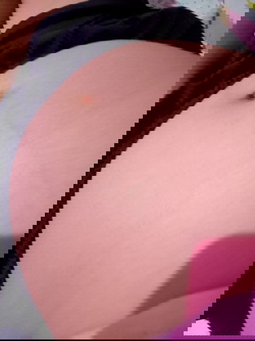 Normal lang po ba yun sumasakit ang bewang?