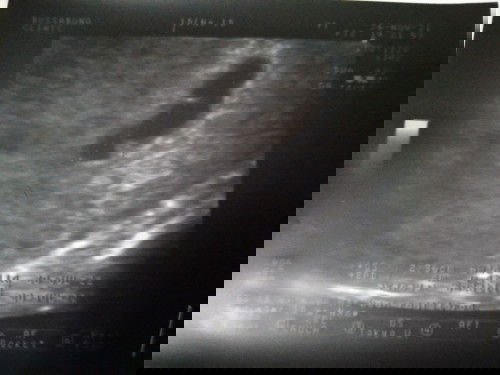 ขอคำแนะนำค่ะ