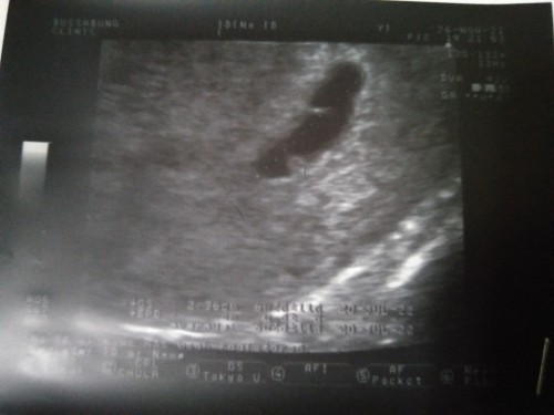 ขอคำแนะนำค่ะ