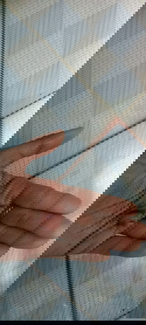 Info Bun pernah ada yg mengalami gak