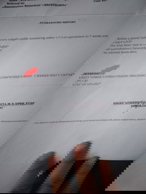 Ultz impression meaning