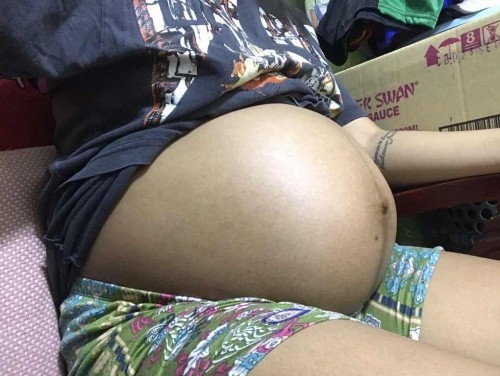 No stretch marks π