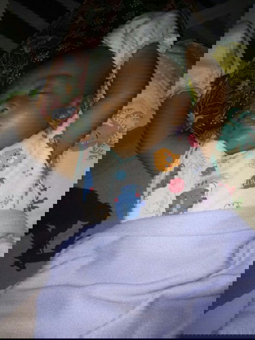 Bayi kuning sudah 1 bulan 2 minggu