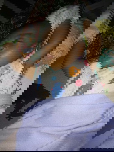 Bayi kuning sudah 1 bulan 2 minggu