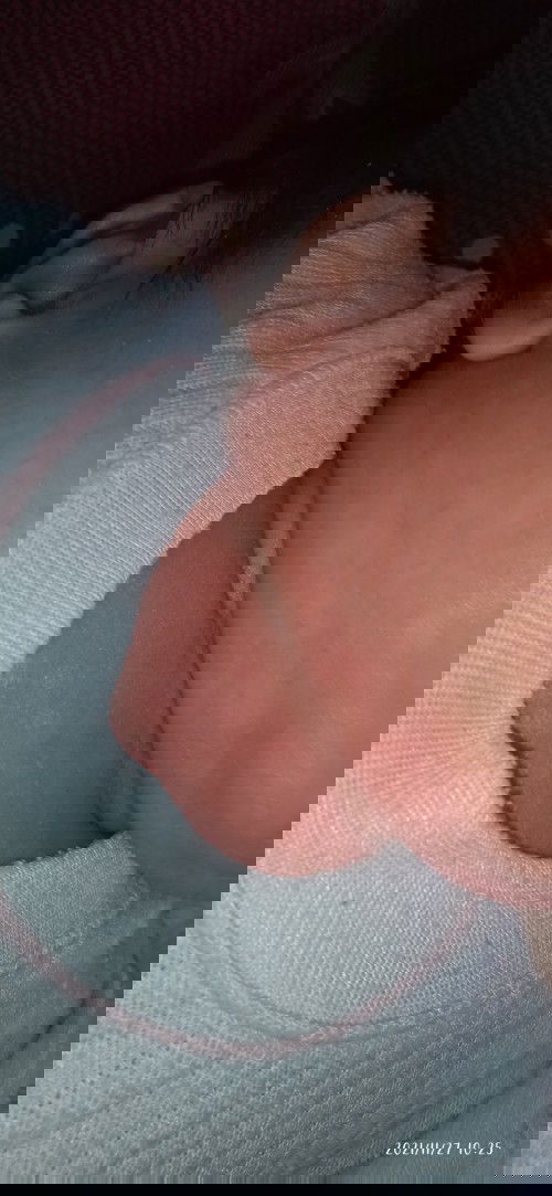 Merah di Dada & leher