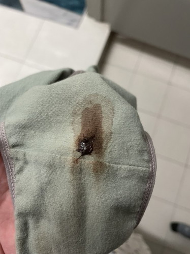 Irregular period?