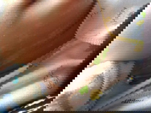 Panu pada wajah bayi