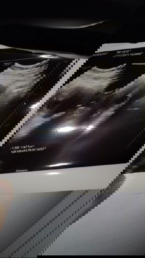 hamil 12 week tidak terlihat janin