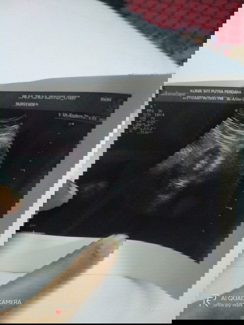 Hai mommy,nak tanye sapa ada pnglmn wt upt +ve tpi blur,breast skt,perut kram tpi wt scan xad apa