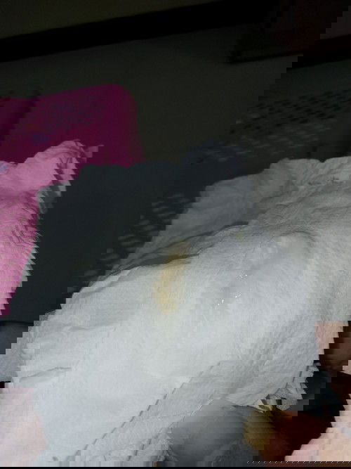 แบบนี้ปกติไหม.