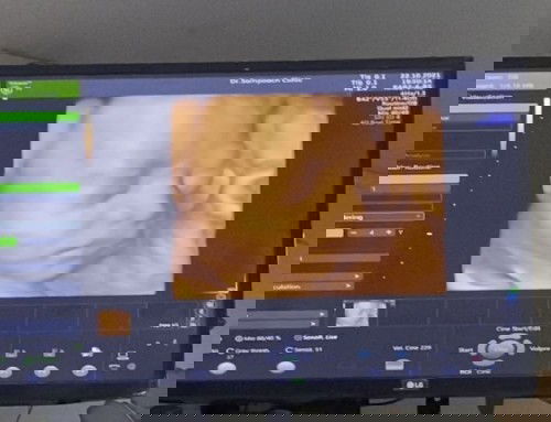 แม่ๆมาอวดรูปลูกๆในท้องกันค่ะ 28week