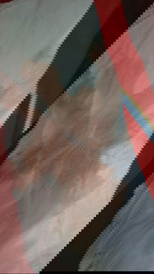 Flek saat hamil muda