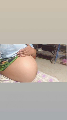 ขอถามแม่ๆ ในช่วงท้องได้36+3 แม่ๆบ้านไหนมีอาการเจ็บช่วงท้องน้อย และน้องสาวบ้างคะ?