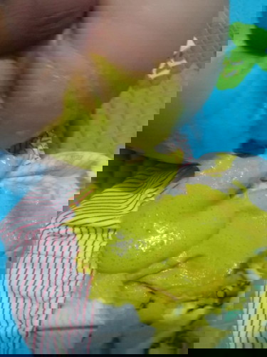 Apakah bab ini normal?