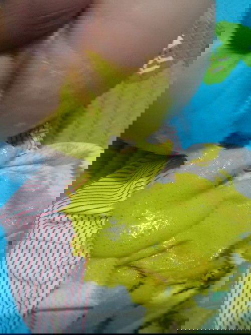 Apakah bab ini normal?