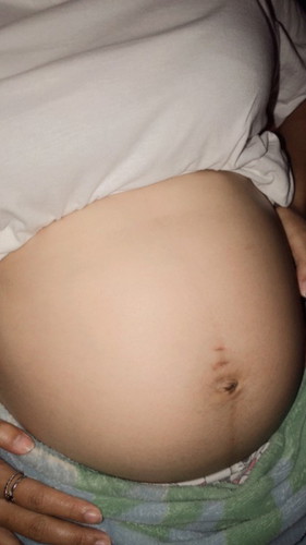 8เดือนแล้วท้องไม่แตกลายมีโอกาสแตกตอน9เดือนมัย