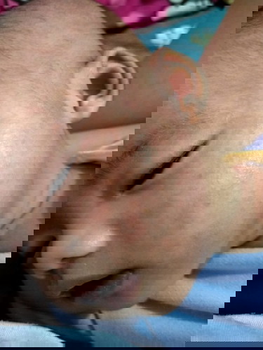 Bun bayi ku umur 3bulan,muka nya sama tangan merah" gitu, ada yg sama ga, pake obat apa ya:( kasian