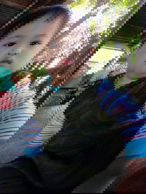 น้องอายุ1ปี1เดือน​มีภาวะ​เลือดกำเดาไหล​ หลายครั้งแล้ว​