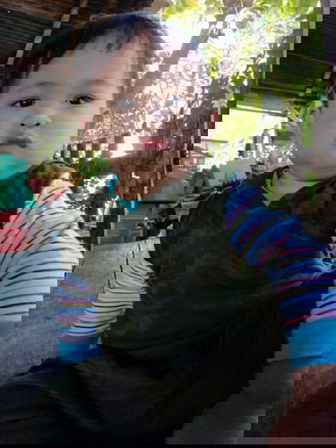 น้องอายุ1ปี1เดือนมีภาวะเลือดกำเดาไหล หลายครั้งแล้ว