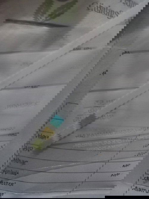 Kaki bengkak uk 35 week