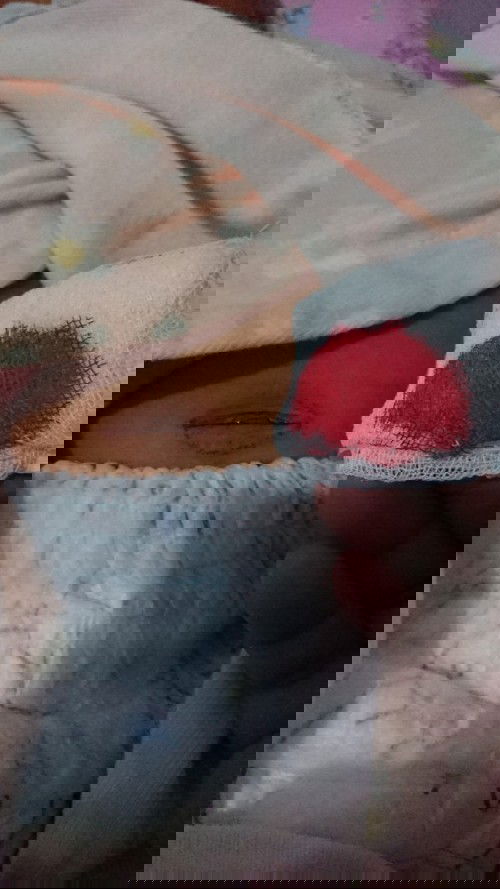 Pusar berdarah babysaya berdarah sdh saya tutup kain kasa steril sdh 3hari ini keluar darah gitu 😢