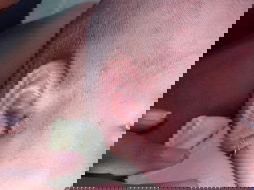 Kuping kuning dan bau amis