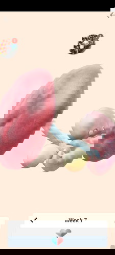 Bunda2 maap usia kehamilan 7 Minggu apakah seperti ini?Ini matanya satu ada putihnya tapi yg satu gd